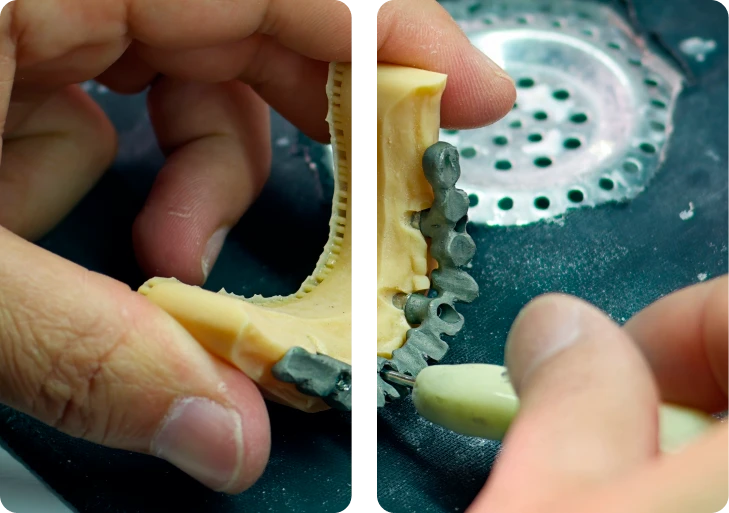 la farola laboratorio protesico dental 2