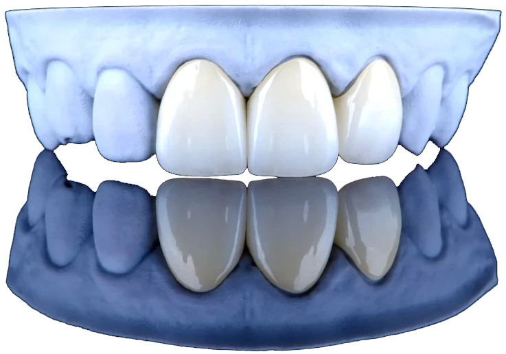 la farola laboratorio protesico dental